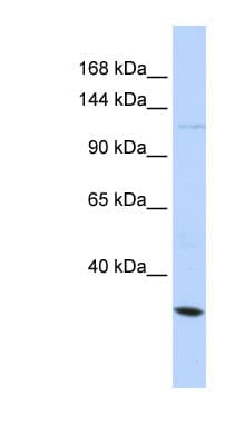 Polyclonal Rabbit anti-Human KCNMA1 / BK Antibody (aa641-690, WB)