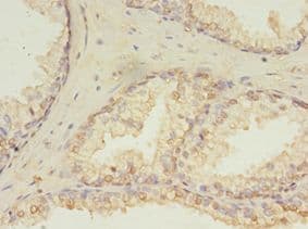 HDDC3 Antibody (aa2-140)
