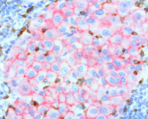 CTNNB1 / Beta Catenin Antibody (clone UMAB15)