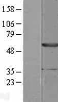 EPHX1 / Epoxide Hydrolase 1 Protein (Over-Expression Lysate Myc-DDK (Flag))
