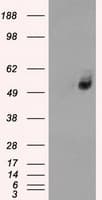 IHC-plus™ Monoclonal Mouse anti-Human SLC2A6 / GLUT6 Antibody (clone 7E3, IHC, IF, WB)
