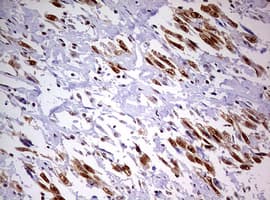 DDX56 Antibody (aa323-547, clone OTI2E5)