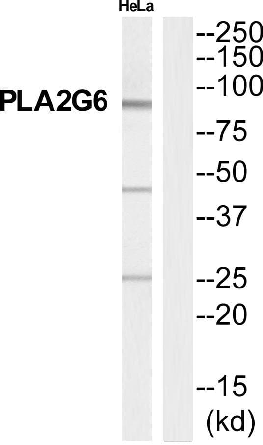 Polyclonal Rabbit anti-Human PLA2G6 / IPLA2 Antibody (WB)