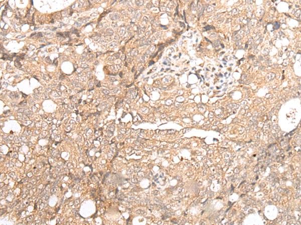 FOXO4 / AFX1 Antibody