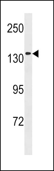 MCM9 Antibody (aa316-345)