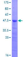 Human RPS7 / Ribosomal Protein S7 (Recombinant GST)