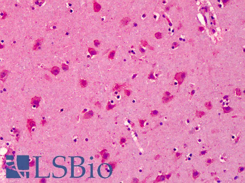 IHC-plus™ SNPH Antibody