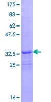 Human FBXL21 Protein (Recombinant GST)