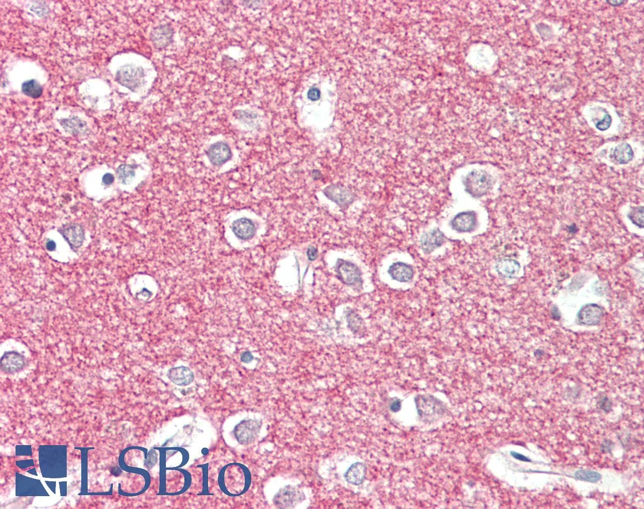 IHC-plus™ Polyclonal Goat anti-Human STX1A / STX1B Antibody (N-Terminus, IHC, WB)