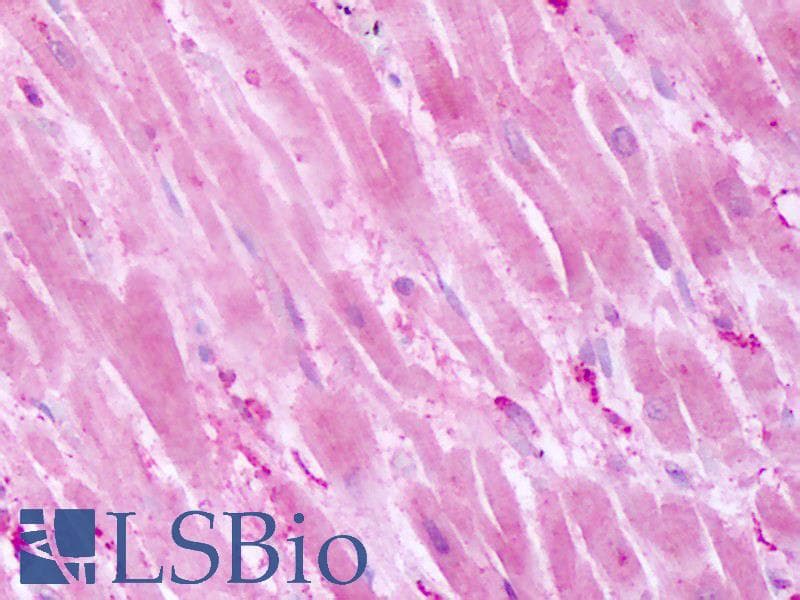 IHC-plus™ PTPRA / RPTP-Alpha Antibody (Cytoplasmic Domain)