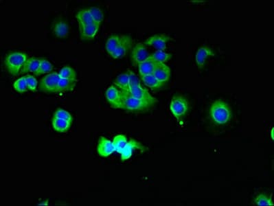 Polyclonal Rabbit anti-Human TMCC1 Antibody (IHC, WB)