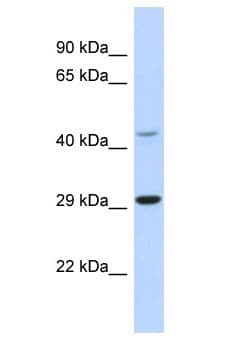 Polyclonal Rabbit anti-Mouse TCFL5 Antibody (aa11-60, WB)