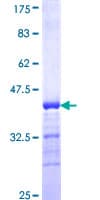 Human TG737 / IFT88 Protein (Recombinant GST, N-terminus)
