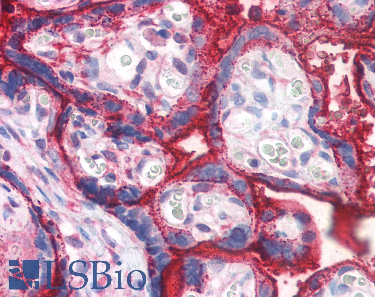 IHC-plus™ Polyclonal Rabbit anti-Human PLAP / Alkaline Phosphatase Antibody (Internal, IHC)