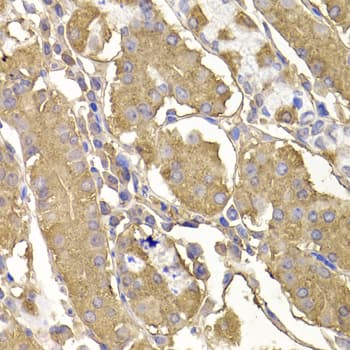 RASGRF1 / CDC25 Antibody