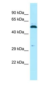 SPAM1 / PH20 Antibody (aa437-486, Biotin)