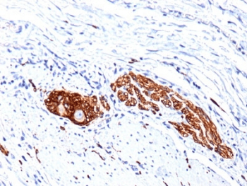 Monoclonal Mouse anti-Human NCAM / CD56 Antibody (clone 56C04 + 123C.D5, Azide-free,BSA-free, IHC)