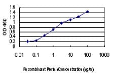 IHC-plus™ MAPK13 / p38delta Antibody (clone 2B2)