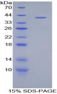 Bovine LF / LTF / Lactoferrin Protein (Recombinant His-T7)