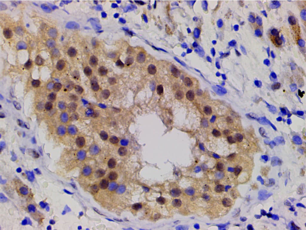 LIMK1 / LIMK Antibody (phospho-Thr508)