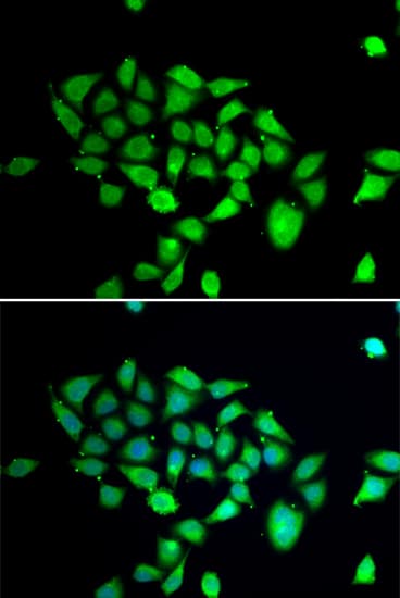 Dipeptidylpeptidase 8 / DPP8 Antibody