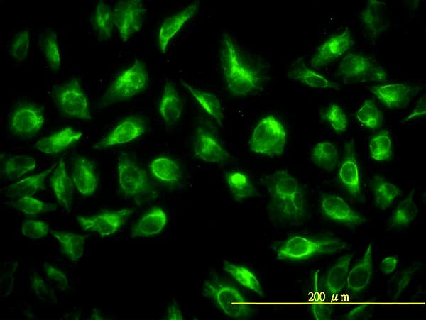 IHC-plus™ TES / Testin Antibody (clone 1G11-B7)