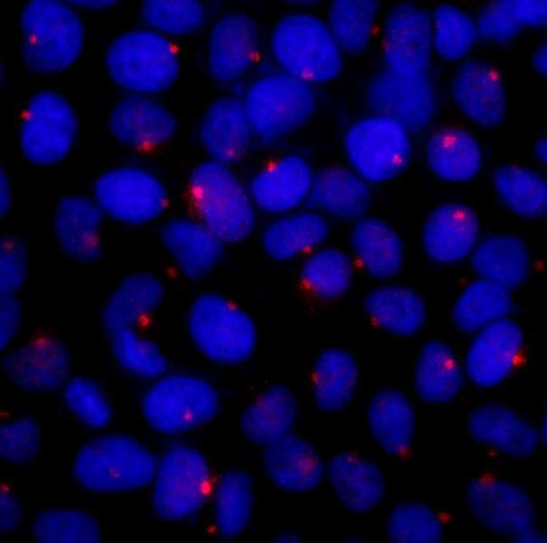 Polyclonal Rabbit anti-Human CEP131 / AZI1 Antibody (aa1-50, IF, WB)