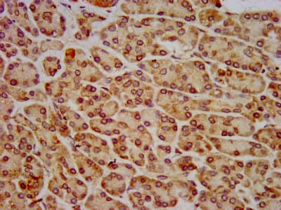 Polyclonal Rabbit anti-Human HIP1R Antibody (IHC, WB)