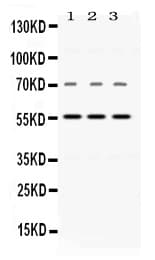NAMPT / Visfatin Antibody