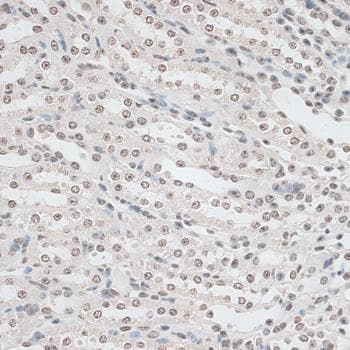 ZNF177 / PIGX Antibody
