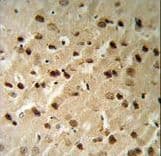 Polyclonal Rabbit anti-Human BECN1 / Beclin-1 Antibody (aa95-132, IHC, WB)