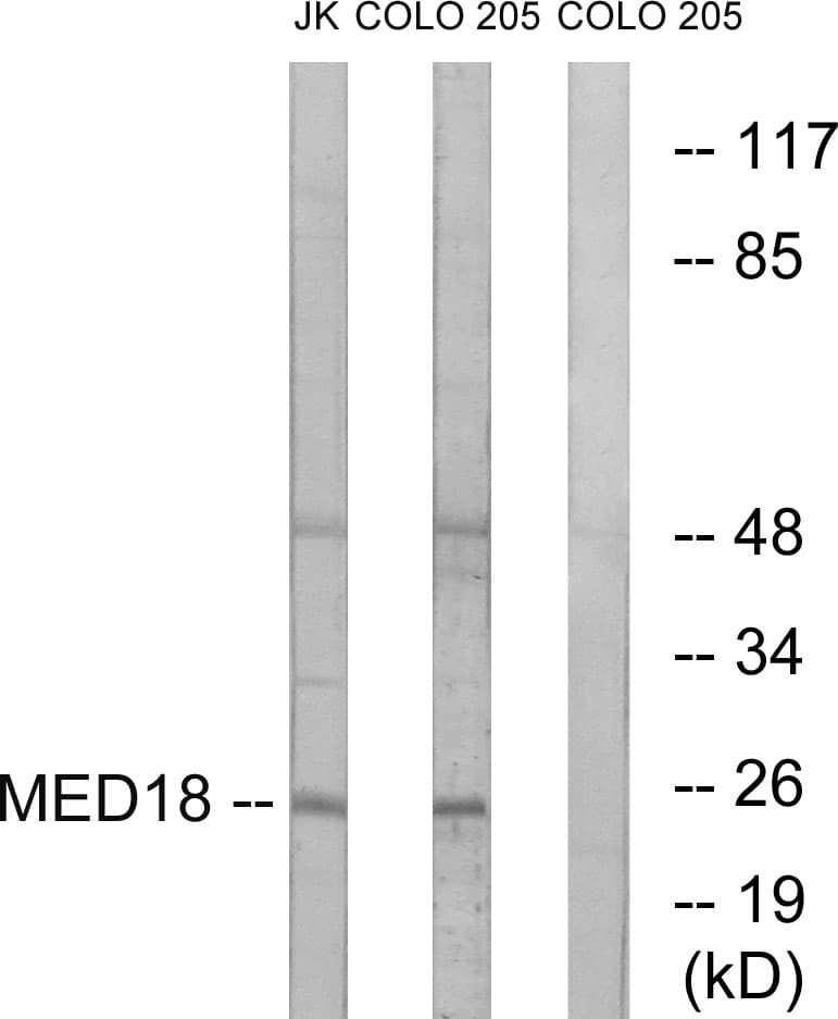 MED18 Antibody (aa70-119)