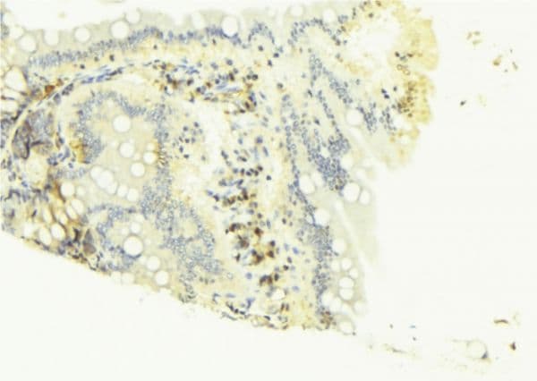 CASP4 / Caspase 4 Antibody