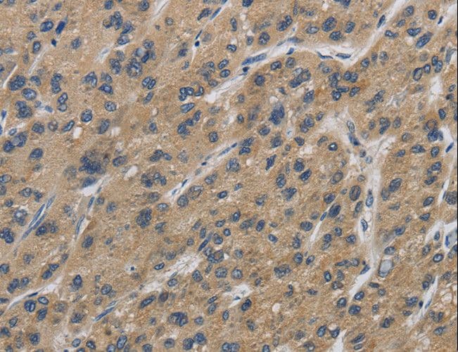 IPO7 / RANBP7 Antibody