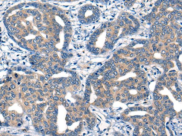 IIP45 / MIIP Antibody