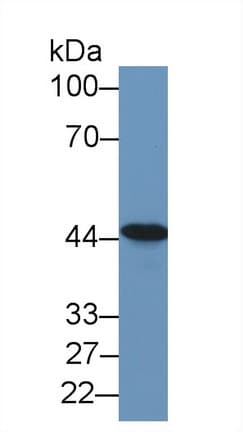 TACR2 / NK2R Antibody (aa92-290)