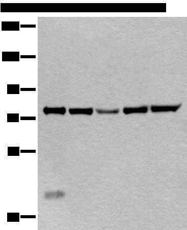 Polyclonal Rabbit anti-Human CREBL1 / ATF6B Antibody (IHC, WB)