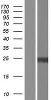 PPT1 / CLN1 Protein (Over-Expression Lysate Myc-DDK (Flag))
