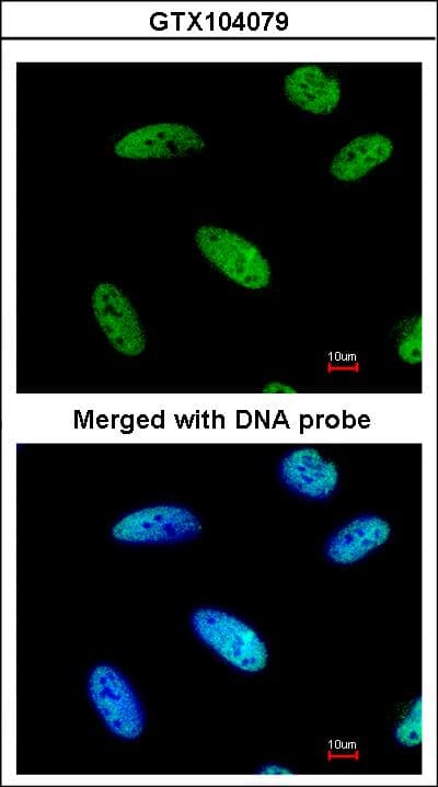 Polyclonal Rabbit anti-Human DNAJC7 Antibody (aa151-473, IHC, WB)