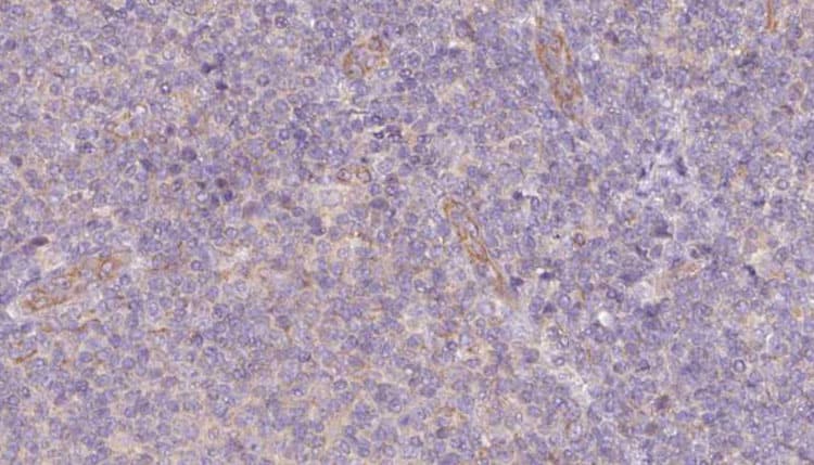 SNAPIN Antibody