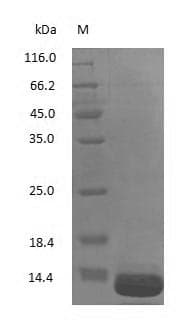 B2M / Beta 2 Microglobulin Protein (Native)