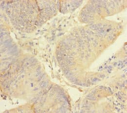 REEP5 Antibody