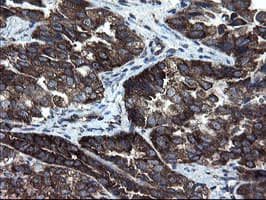 CNOT4 / CLONE243 Antibody (clone OTI1H2)