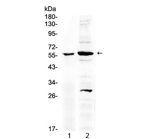 Polyclonal Rabbit anti-Mouse TNFRSF1A / TNFR1 Antibody (WB)