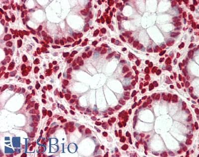 SMARCE1 / BAF57 Antibody (aa39-88)