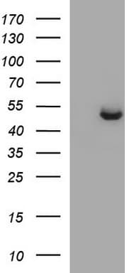 SPHK / SPHK1 Antibody (clone OTI1A6, Carrier-free)