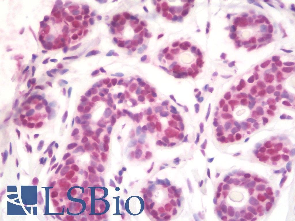 IHC-plus™ Monoclonal Mouse anti-Human CTBP1 / CTBP Antibody (clone 2G7, IHC, IF, WB)
