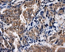 NPR3 Antibody (clone OTI2G2)
