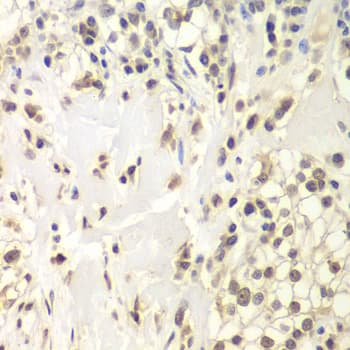 USP7 / HAUSP Antibody