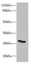 Polyclonal Rabbit anti-Human CLDN18 / Claudin 18 Antibody (IHC, WB)